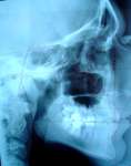 skull x-ray skull x-ray